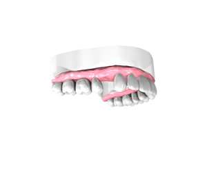 Examen pre-implantaire – Dentiste Orléans